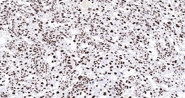 Histone H2A.X Antibody in Immunohistochemistry (Paraffin) (IHC (P))
