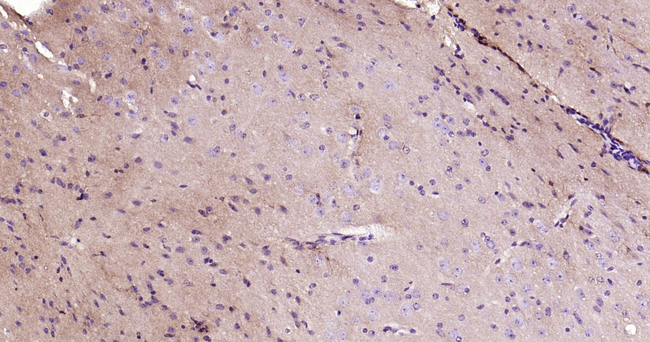TrkB Antibody in Immunohistochemistry (Paraffin) (IHC (P))