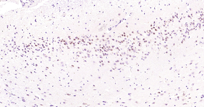 JNK1 Antibody in Immunohistochemistry (Paraffin) (IHC (P))