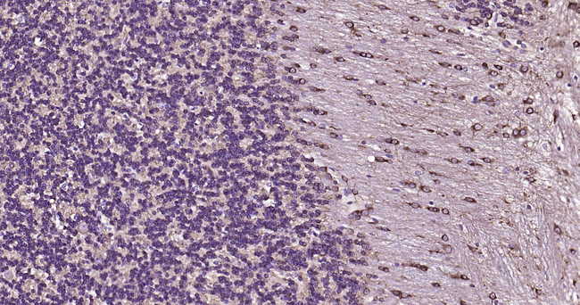 Beclin 1 Antibody in Immunohistochemistry (Paraffin) (IHC (P))
