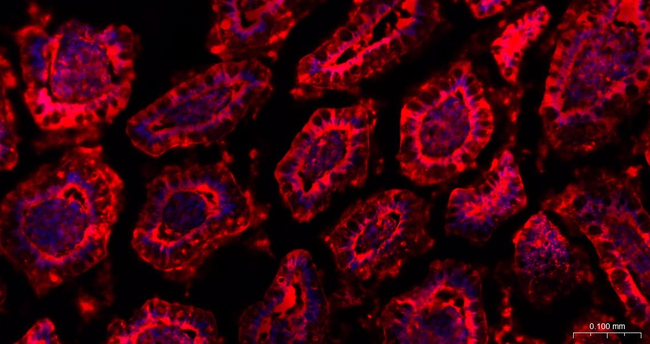 Galectin 3 Antibody in Immunohistochemistry (Paraffin) (IHC (P))
