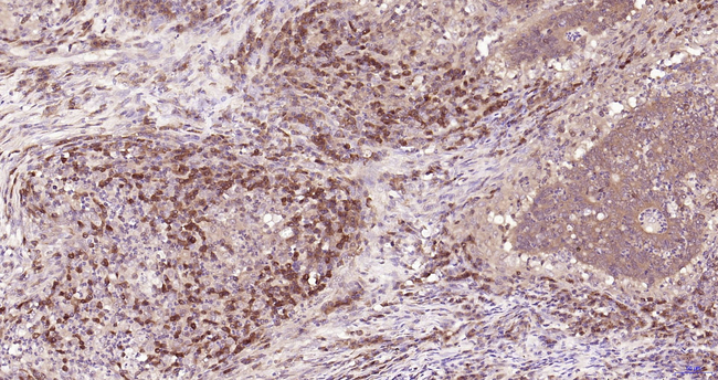 Caspase 3 p17 Antibody in Immunohistochemistry (Paraffin) (IHC (P))