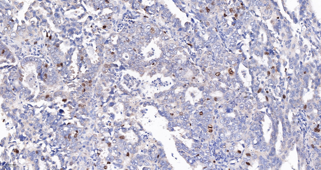 KIFC1 Antibody in Immunohistochemistry (Paraffin) (IHC (P))