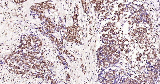 Phospho-CREB (Ser133) Antibody in Immunohistochemistry (Paraffin) (IHC (P))