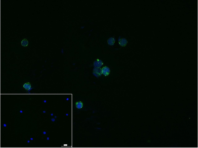 CCR9 Antibody in Immunocytochemistry (ICC/IF)