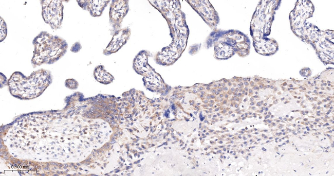 Phospho-PP2A alpha (Ser307) Antibody in Immunohistochemistry (Paraffin) (IHC (P))
