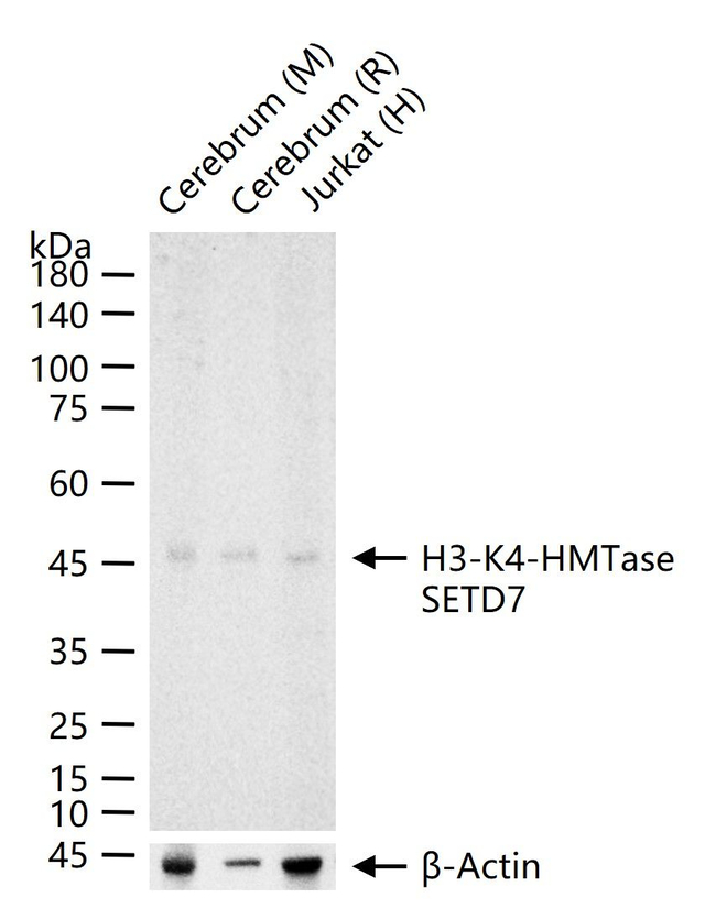 SETD7 Antibody in Western Blot (WB)