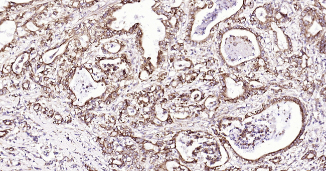 SHH Antibody in Immunohistochemistry (Paraffin) (IHC (P))
