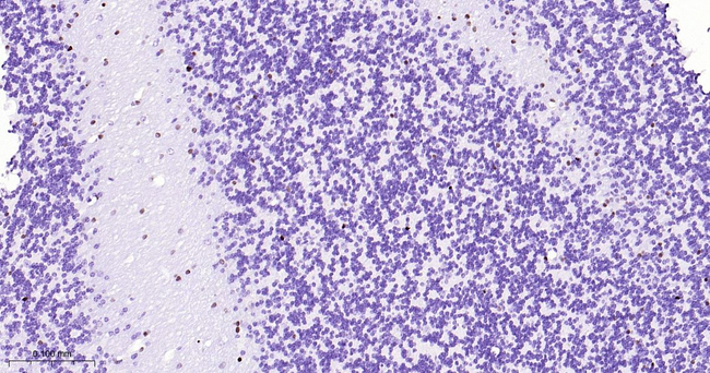 OLIG2 Antibody in Immunohistochemistry (Paraffin) (IHC (P))