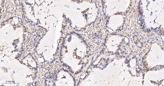 ENO1 Antibody in Immunohistochemistry (Paraffin) (IHC (P))