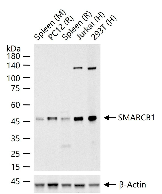 SMARCB1 Antibody in Western Blot (WB)