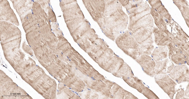 Plectin Antibody in Immunohistochemistry (Paraffin) (IHC (P))