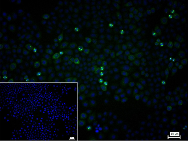 TACC3 Antibody in Immunocytochemistry (ICC/IF)