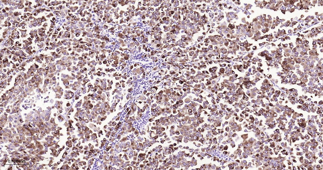 PMEL Antibody in Immunohistochemistry (Paraffin) (IHC (P))