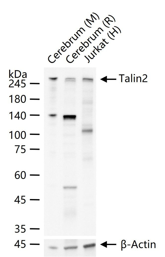 Talin 2 Antibody in Western Blot (WB)