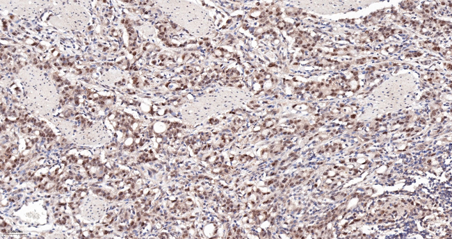 CK2 alpha-1 Antibody in Immunohistochemistry (Paraffin) (IHC (P))