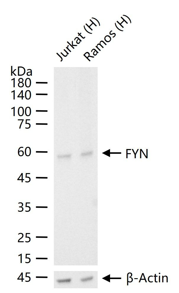 Fyn Antibody in Western Blot (WB)