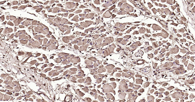Calmodulin 1/2/3 Antibody in Immunohistochemistry (Paraffin) (IHC (P))