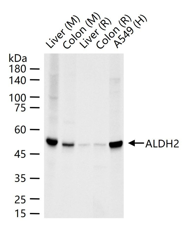 ALDH2 Antibody in Western Blot (WB)