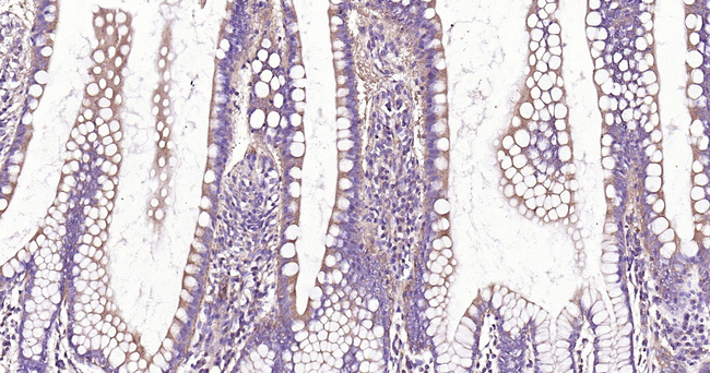 DAPK1 Antibody in Immunohistochemistry (Paraffin) (IHC (P))