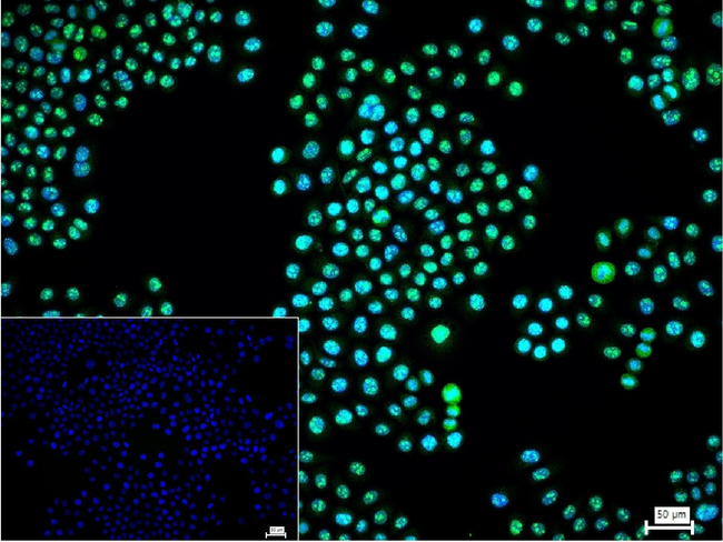 MNAR Antibody in Immunocytochemistry (ICC/IF)