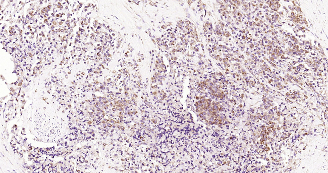 VPS34 Antibody in Immunohistochemistry (Paraffin) (IHC (P))