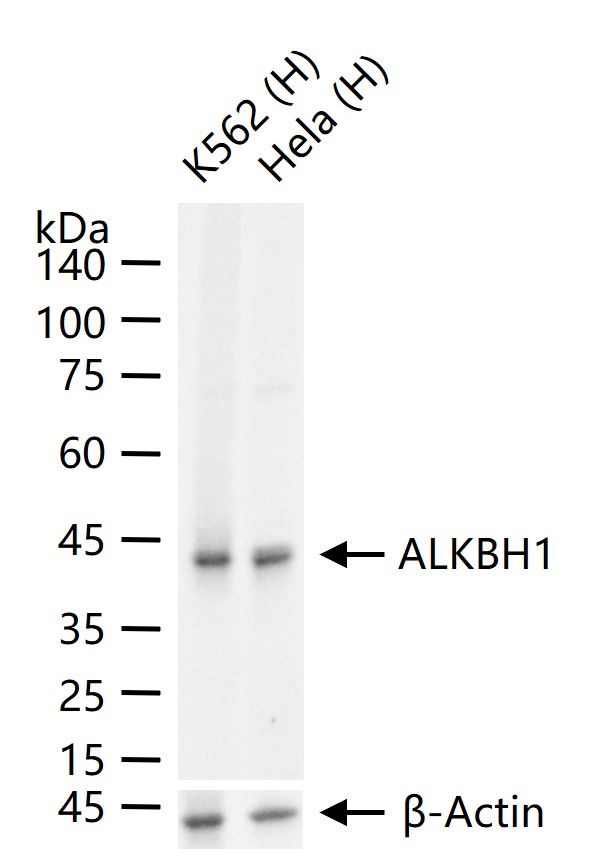 ABH1 Antibody in Western Blot (WB)