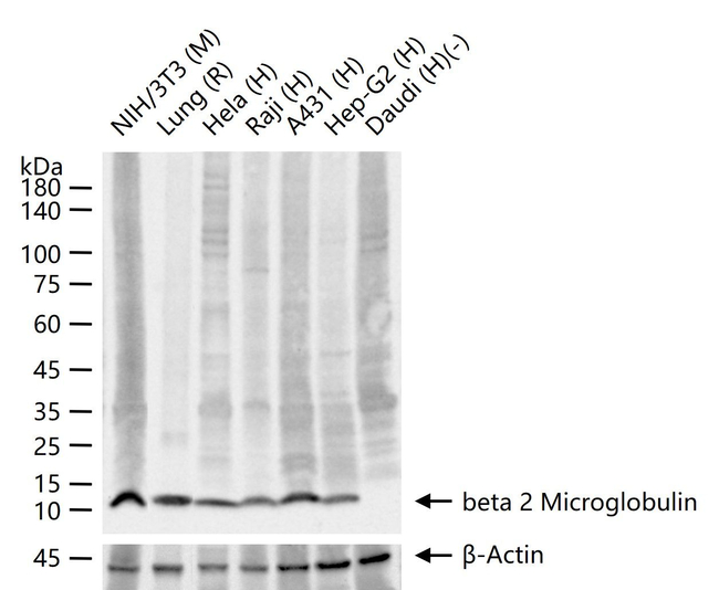 beta-2 Microglobulin Antibody in Western Blot (WB)