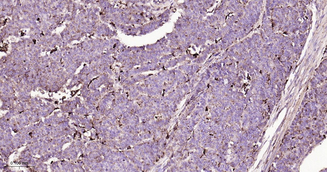 Cathepsin D Antibody in Immunohistochemistry (Paraffin) (IHC (P))