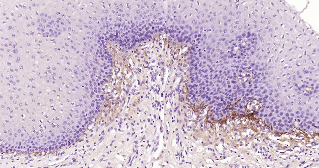 Tenascin C Antibody in Immunohistochemistry (Paraffin) (IHC (P))