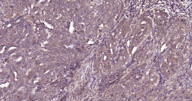 ASK1 Antibody in Immunohistochemistry (Paraffin) (IHC (P))