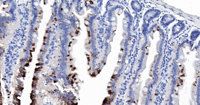 S100A8 Antibody in Immunohistochemistry (Paraffin) (IHC (P))