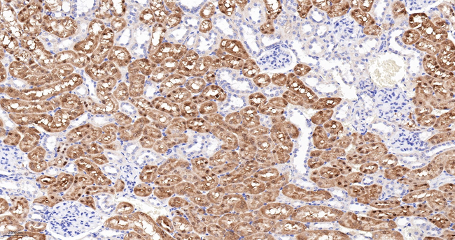 ABH1 Antibody in Immunohistochemistry (Paraffin) (IHC (P))