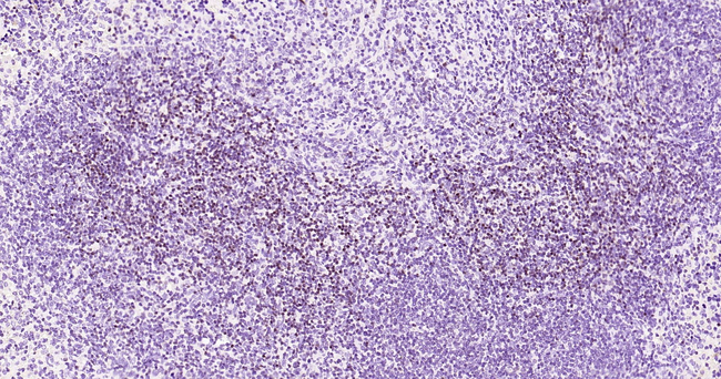 LEF1 Antibody in Immunohistochemistry (Paraffin) (IHC (P))