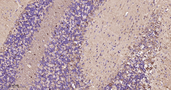 DARPP-32 Antibody in Immunohistochemistry (Paraffin) (IHC (P))