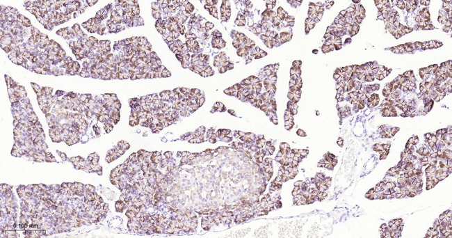 SSTR2 Antibody in Immunohistochemistry (Paraffin) (IHC (P))