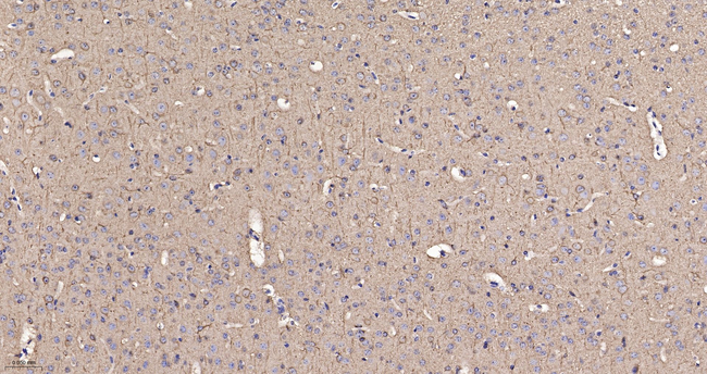 TUBB4B/TUBB2A/TUBB2B Antibody in Immunohistochemistry (Paraffin) (IHC (P))