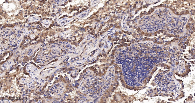 beta Arrestin 1 Antibody in Immunohistochemistry (Paraffin) (IHC (P))