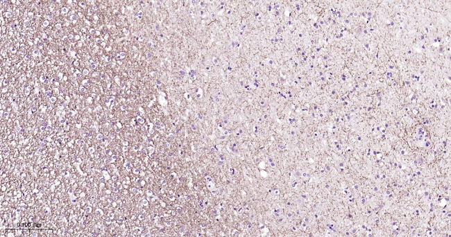 gamma Tubulin Antibody in Immunohistochemistry (Paraffin) (IHC (P))