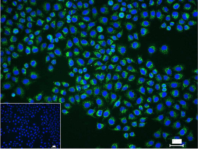 TSPO Antibody in Immunocytochemistry (ICC/IF)