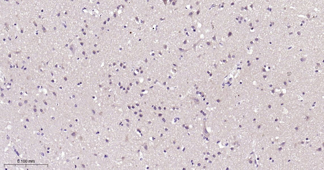 HSC70 Antibody in Immunohistochemistry (Paraffin) (IHC (P))