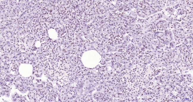 BRD4 Antibody in Immunohistochemistry (Paraffin) (IHC (P))