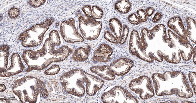 PUMA alpha Antibody in Immunohistochemistry (Paraffin) (IHC (P))
