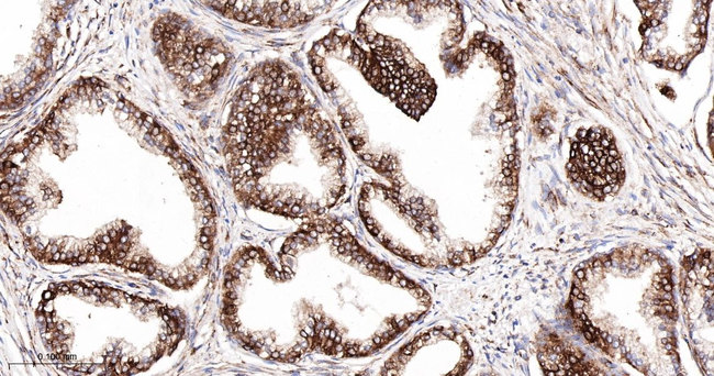 YBX1 Antibody in Immunohistochemistry (Paraffin) (IHC (P))