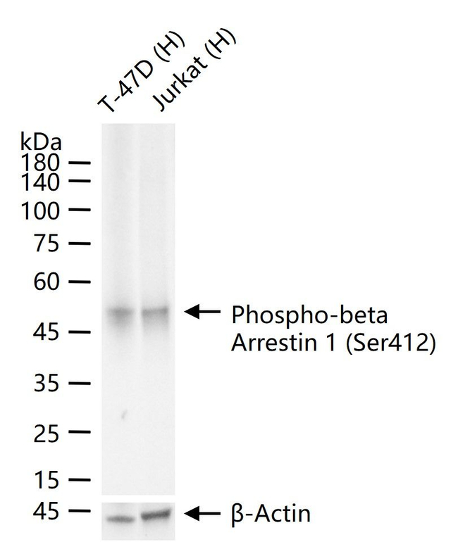 Phospho-beta Arrestin 1 (Ser412) Antibody in Western Blot (WB)