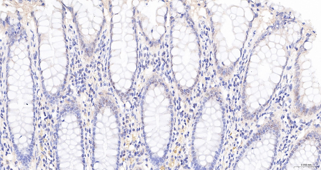 NUP98 Antibody in Immunohistochemistry (Paraffin) (IHC (P))