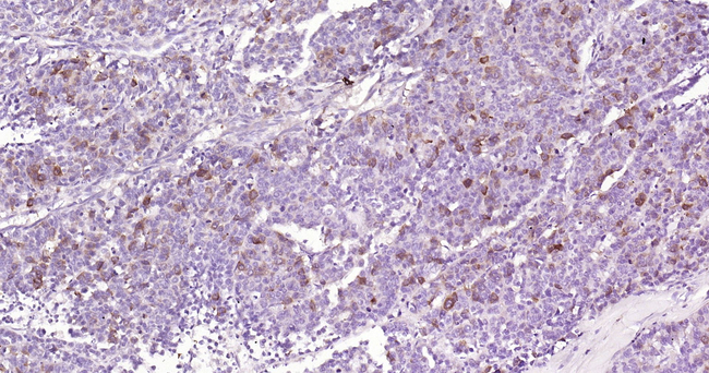 Phospho-CDK1/CDK2 (Thr14) Antibody in Immunohistochemistry (Paraffin) (IHC (P))