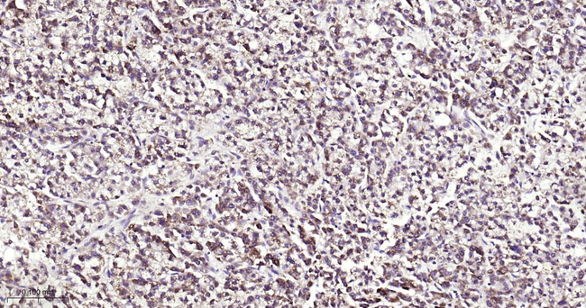 ATG12 Antibody in Immunohistochemistry (Paraffin) (IHC (P))