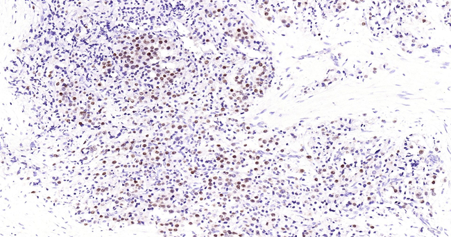 Androgen Receptor Antibody in Immunohistochemistry (Paraffin) (IHC (P))