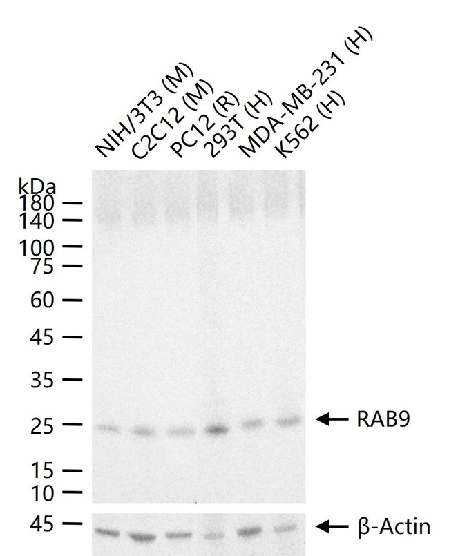 RAB9 Antibody in Western Blot (WB)